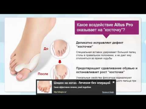 имбирь при подагре/#anti-hemorrhoids