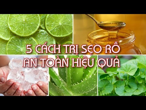 Trị sẹo rỗ chỉ với những mẹo đơn giản này | Mẹo làm đẹp