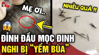 Đang 'LÀM TÓC' cho mẹ, con gái 'HỐT HOẢNG' phát hiện 'ĐINH KIM' mọc trên đỉnh đầu | Tin 3 Phút Bí Ẩn