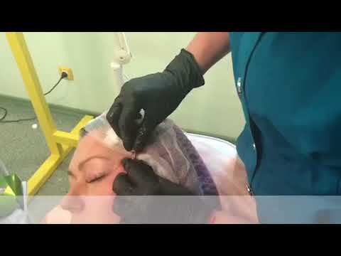 Подтяжка лица 6 D cogi