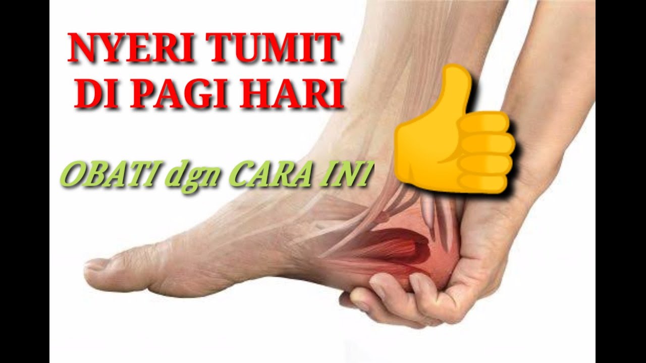 Cara MUDAH MENYEMBUHKAN Nyeri Tumit /Calcaneus Spur/Fascitis Plantaris
