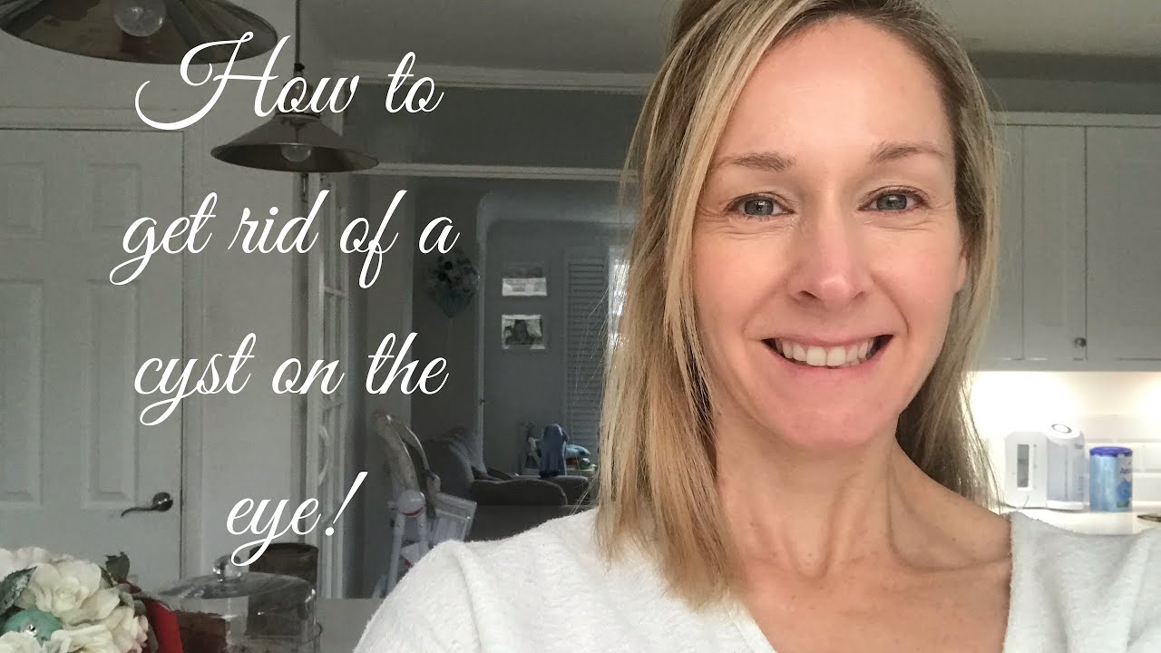 How To Get Rid Of A Cyst On The Eye YouTube