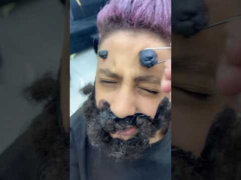 ازالة الحباية المتسلطنة من القورة