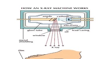 SNIT KTU S8 MECH BIOMEDICAL ENGG MODULE 5: Medical Imaging System