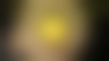 Endocapsular Carousel Technique Phacoemulsification