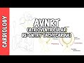 AVRNT (atrioventricular re-entry tachycardia) - causes, pathophysiology, treatment