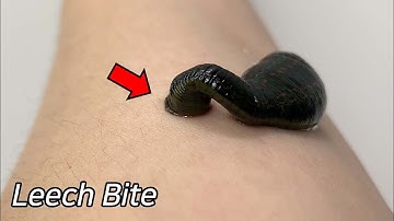 Strange Scars on Leech Bite !