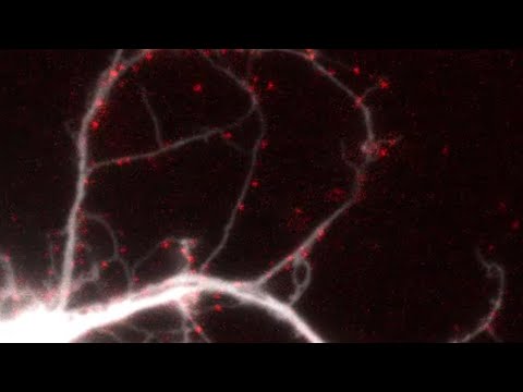 Single molecule imaging of SARS-CoV-2 spike protein (red) on a live brain cell