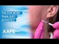 Tox For More Than Just Esthetics Tox For More Than Just Esthetics