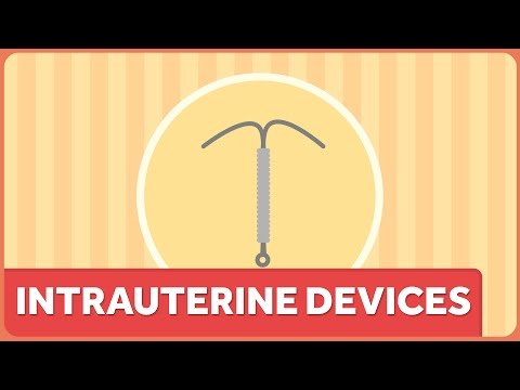 Video: IUD Vs. Tableta: Poznajte Svoje Možnosti