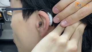 Designing and Evaluating the User Experience of Wearable Assistive Devices for Single-Sided Deafness