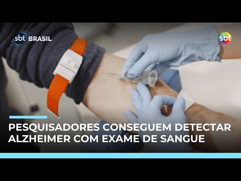 Video pesquisadores-brasileiros-desenvolvem-exame-de-sangue-para-detectar-alzheimer