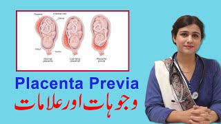 Placenta Previa Reasons & Treatment - Dr Maryam Raana Gynaecologist Resimi