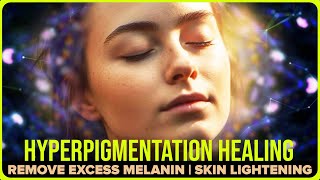 Binaural Beats for Anti-Aging and Skin Lightening: Hyperpigmentation Healing Frequency (Subliminal) by Spiritual Growth - Binaural Beats Meditation 968 views 4 months ago 1 hour, 2 minutes