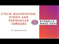 Eyelid malposition, ptosis and periocular tumours