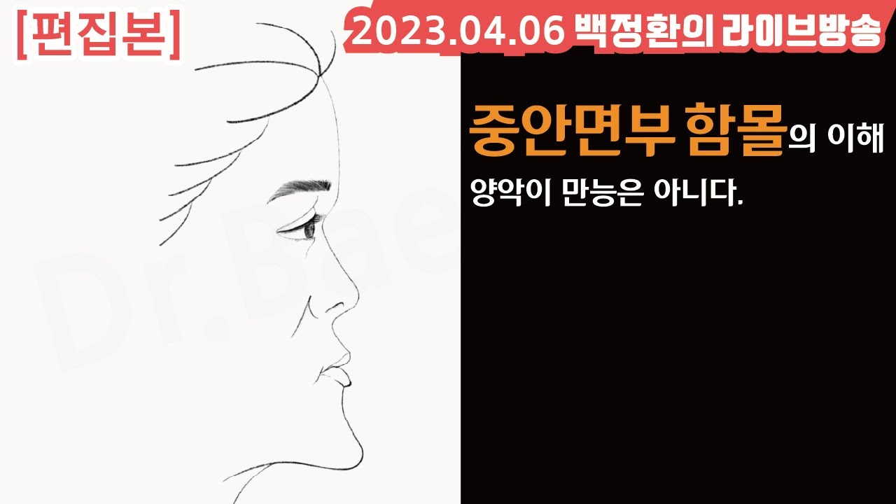 [백정환의 목요라방 편집본 #80] 중안면부 함몰의 이해