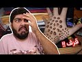 أتحداك تدخل ولا تتقرف ! ( تحذير مناظر مقرفة ) - مرض الـ Trypophobia