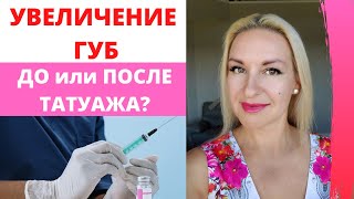 Увеличение губ филлерами. ДО или ПОСЛЕ Татуажа губ?