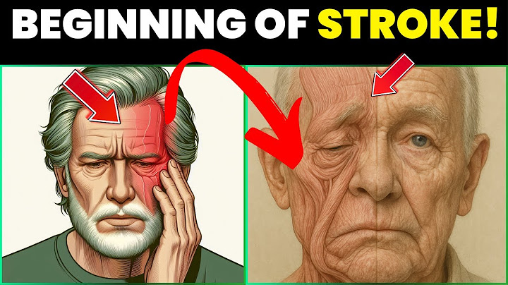 72 Hours Before a Stroke: Your Body May Do These 8 Things