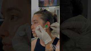 #piercing #lobepiercing #traguspiercing #helixpiercing #safepiercing #daithpiercing #conchpiercing