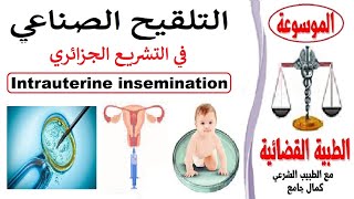 التلقيح الصناعي في التشريع الجزائري Intrauterine insemination