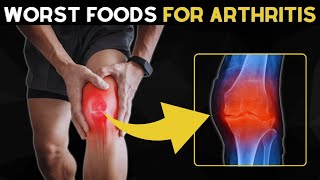 12 Foods To Avoid If You Have Arthritis | Inflammatory Foods to Avoid for ARTHRITIS