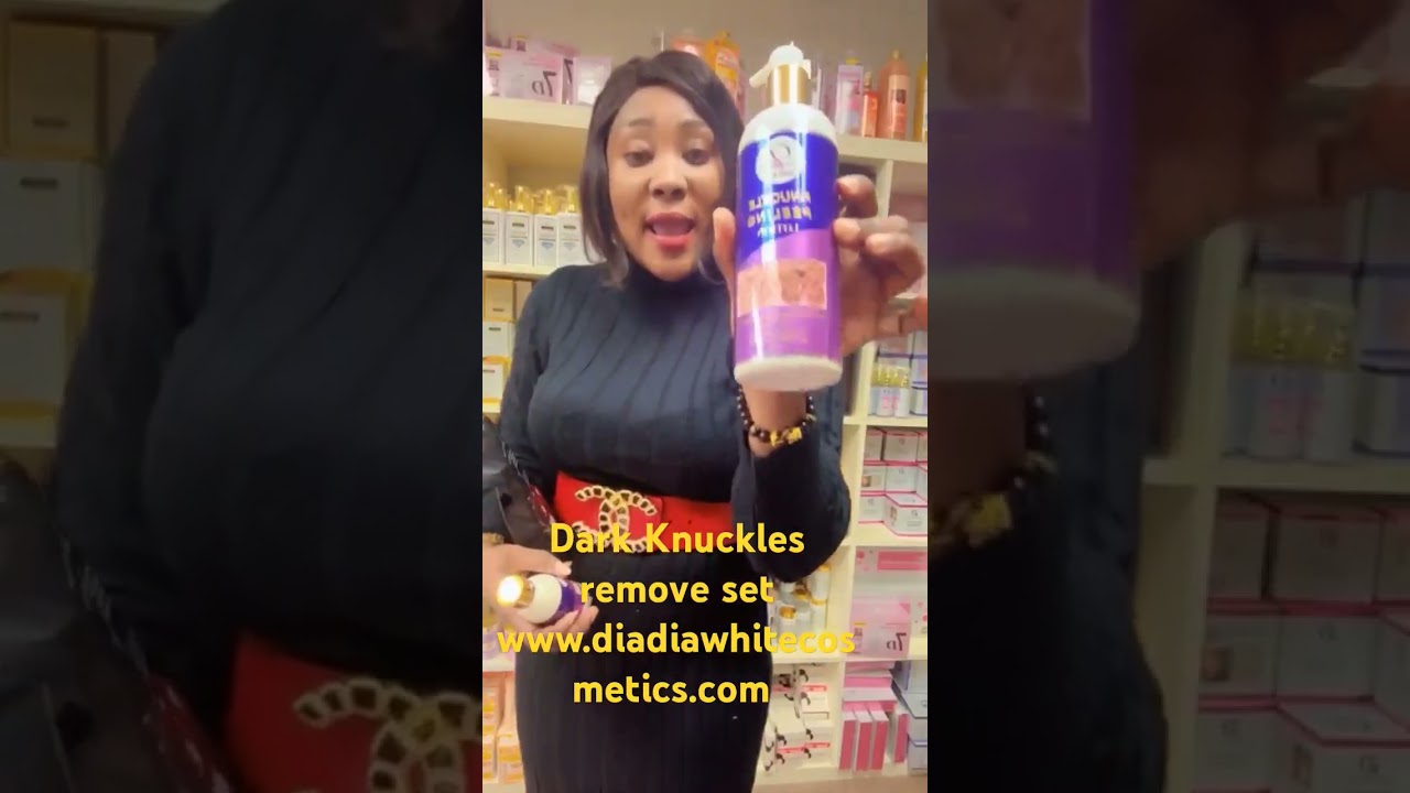 Strong Whitening Cream Lotion Removing Dark Tea Knuckle Finger Elbow Knee Bleaching