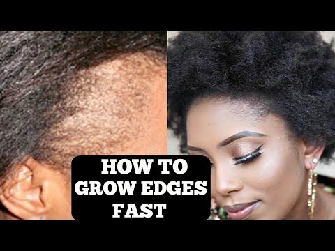 how-to-grow-your-thin/bald-edges-in-3-days-(guaranteed)