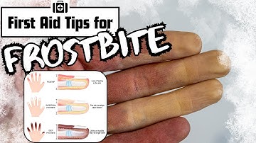 Frostbite - Symptoms and First Aid