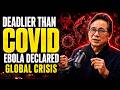 Ebola Virus Outbreak Explained: Symptoms, Spread &amp; Survival | Dr. William Li