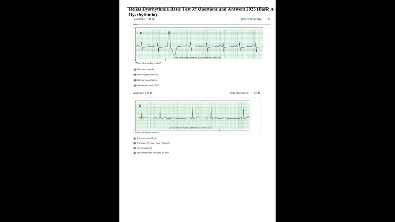 Relias Dysrhythmia Basic Test 35 Questions and Answers 2023 Basic A