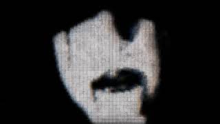 SURGERYHEAD-HEARTBLEED