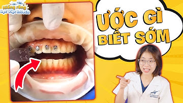 5 Điều Cần Biết Trước Khi Gắn Mắc Cài | Chia Sẻ Kiến Thức | Lạc Việt Intech Niềng Răng