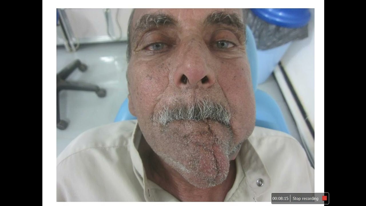 Accepted Abstracts - IAOMS