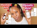 THE ORDINARY MANDELAIC ACID VS GLYCOLIC ACID | Good for hyperpigmentation acne, rosacea fine lines