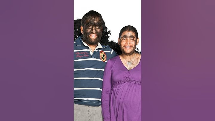 This is the world's hairiest family 👀