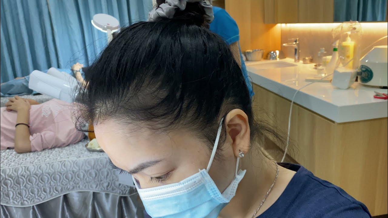 Acne Treatment Sac Dep Spa YouTube