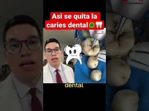 Video: 3 formas de ocultar la caries dental