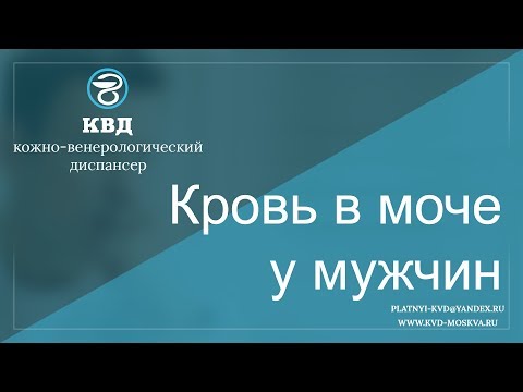 74  Кровь в моче у мужчин