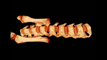 Mouse Spinal Column and Vertebrae - MicroCT (micro computed tomography) 3D X-Ray