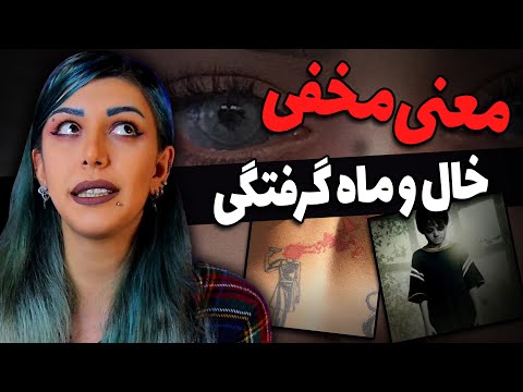 ❌کشف قتل با لکه ماه گرفتگی ❌معنی های عجیب و مخفی خال و لکه های مادرزادی