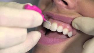 How to use an interdental brush - AJ Hedger screenshot 3