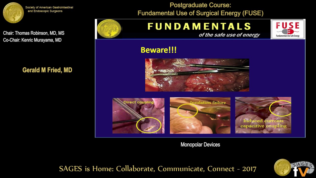 Monopolar electrosurgery YouTube