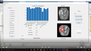 Brain tumor detection using different machine learning algorithm using MATLAB | MATLAB solutions