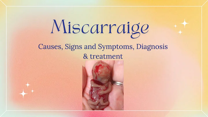 MISCARRIAGE, Causes, Signs and Symptoms, Diagnosis and Treatment. - DayDayNews