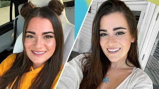 My Smile Transformation! Veneers Experience | Cloe Feldman