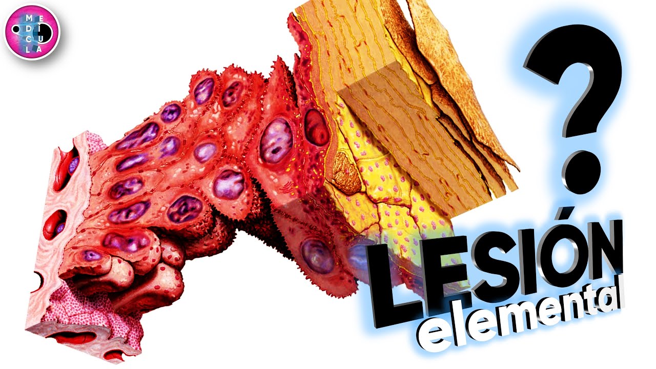 🔥LESIONES ELEMENTALES | Dermatología | Explicación clara