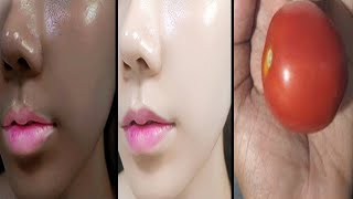 7 Days Challenge I Removed Dark Spots & Hyper pigmentation | Spotless Clear Skin | Pure Beauty Tips