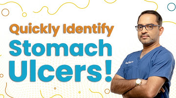 How to know if you have Stomach Ulcer | Dr. Deepak Subramanian