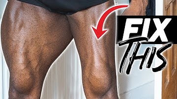 Do This To Fix Your Muscle Imbalance | 3 Easy Steps